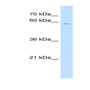 anti-Chondroitin Sulfate N-Acetylgalactosaminyltransferase 1 (CSGALNACT1) (N-Term) antibody avatar