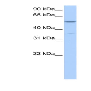 anti-Choline Kinase alpha (CHKA) (Middle Region) antibody avatar