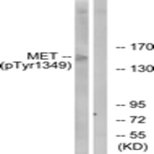 anti-Met Proto-Oncogene (MET) (pTyr1349) antibody avatar