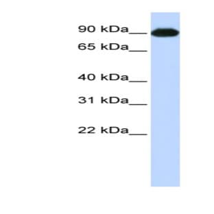 anti-CTAGE Family, Member 5 (CTAGE5) (Middle Region) antibody avatar