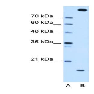 anti-CTAGE Family, Member 5 (CTAGE5) (Middle Region) antibody avatar