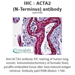 anti-Actin, alpha 2, Smooth Muscle, Aorta (ACTA2) (N-Term) antibody avatar