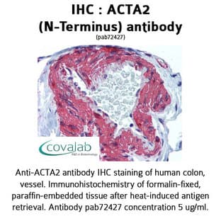 anti-Actin, alpha 2, Smooth Muscle, Aorta (ACTA2) (N-Term) antibody avatar