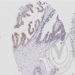 anti-Caspase 7, Apoptosis-Related Cysteine Peptidase (CASP7) antibody avatar