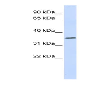 anti-Chromosome 2 Open Reading Frame 60 (C2orf60) (Middle Region) antibody avatar
