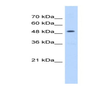 anti-3-Hydroxy-3-Methylglutaryl-CoA Synthase 2 (Mitochondrial) (HMGCS2) (N-Term) antibody avatar
