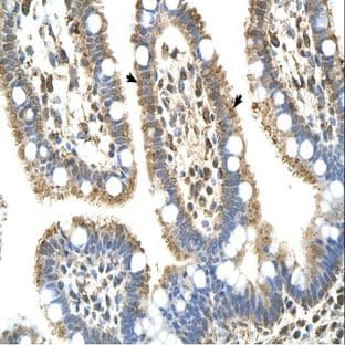 anti-Complement Component 8, beta Polypeptide (C8B) (Middle Region) antibody avatar