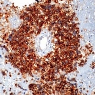 anti-CD99 (CD99) antibody avatar