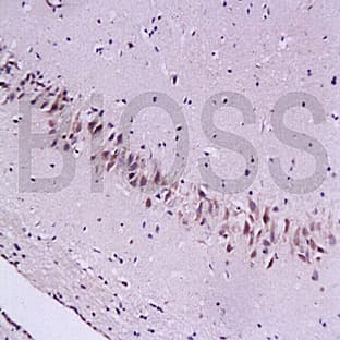 anti-Cytoglobin (CYGB) antibody avatar