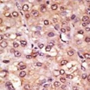 anti-Achaete-Scute Complex Homolog 1 (Drosophila) (ASCL1) (C-Term) antibody avatar