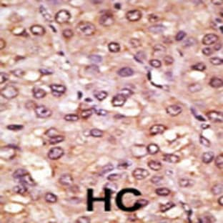 anti-Achaete-Scute Complex Homolog 1 (Drosophila) (ASCL1) (AA 166-196), (C-Term) antibody avatar