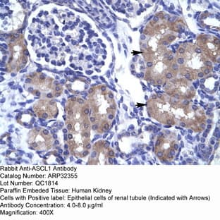 anti-Achaete-Scute Complex Homolog 1 (Drosophila) (ASCL1) (N-Term) antibody avatar