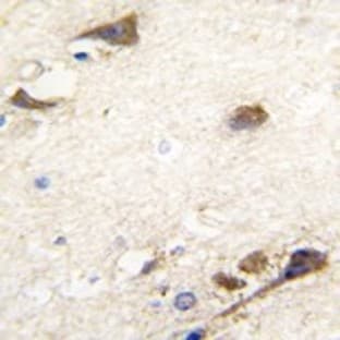 anti-Acetylcholinesterase (AChE) (N-Term) antibody avatar