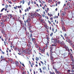 anti-6-phosphogluconolactonase (PGLS) (Middle Region) antibody avatar