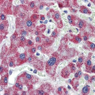 anti-Acetyl-CoA Acyltransferase 1 (ACAA1) (N-Term) antibody avatar