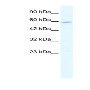 anti-DEAD (Asp-Glu-Ala-Asp) Box Polypeptide 47 (DDX47) (N-Term) antibody avatar