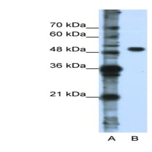 anti-DEAD (Asp-Glu-Ala-Asp) Box Polypeptide 47 (DDX47) (N-Term) antibody avatar