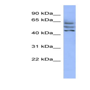 anti-Coiled-Coil Domain Containing 174 (CCDC174) (Middle Region) antibody avatar