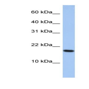 anti-ADP-Ribosylation Factor-Like 5A (ARL5A) (Middle Region) antibody avatar