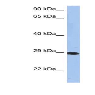 anti-Crystallin, beta A1 (CRYBA1) (N-Term) antibody avatar