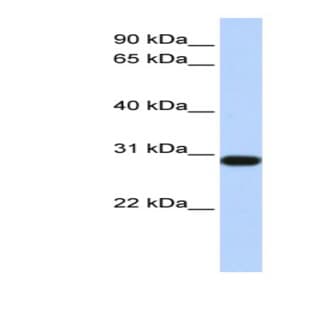 anti-2,3-bisphosphoglycerate Mutase (BPGM) (Middle Region) antibody avatar