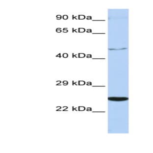 anti-Cytokine Receptor-Like Factor 1 (CRLF1) (Middle Region) antibody avatar