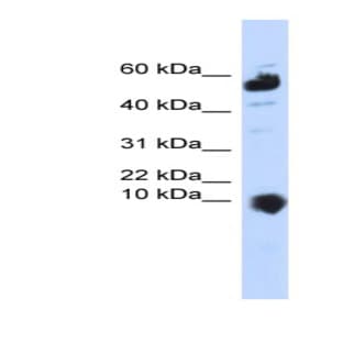 anti-Chromosome 1 Open Reading Frame 151 (C1orf151) (Middle Region) antibody avatar