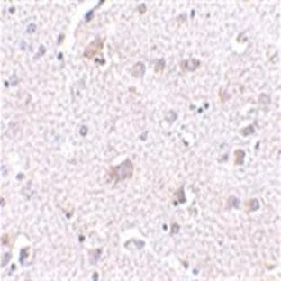 anti-Cerebral Dopamine Neurotrophic Factor (CDNF) (C-Term) antibody
