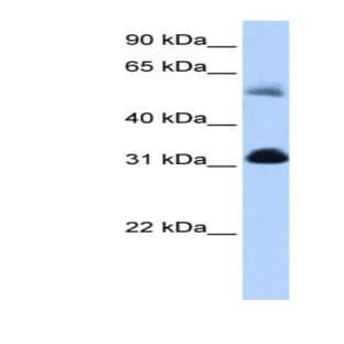 anti-3-Oxoacid CoA Transferase 1 (OXCT1) (N-Term) antibody avatar