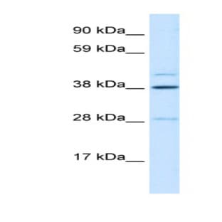 anti-Ceramide Synthase 3 (CERS3) (N-Term) antibody avatar