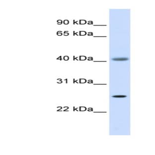 anti-Adenosine Deaminase (ADA) (Middle Region) antibody avatar