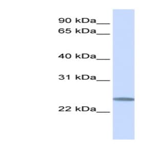anti-Chromosome 12 Open Reading Frame 49 (C12orf49) (C-Term) antibody avatar