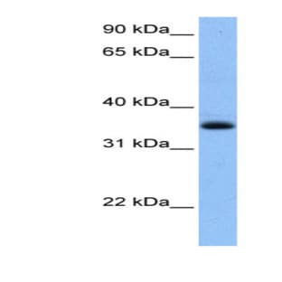 anti-Chimerin (Chimaerin) 2 (CHN2) (N-Term) antibody avatar