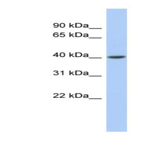 anti-Acyl-CoA Dehydrogenase, C-2 To C-3 Short Chain (Acads) (Middle Region) antibody avatar