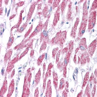anti-Acetyl-CoA Acetyltransferase 1 (ACAT1) (Middle Region) antibody avatar