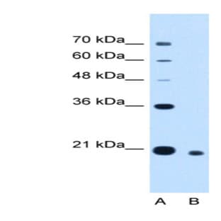 anti-Cell Division Cycle Associated 4 (CDCA4) (N-Term) antibody avatar