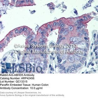 anti-Abhydrolase Domain Containing 5 (ABHD5) (C-Term) antibody avatar