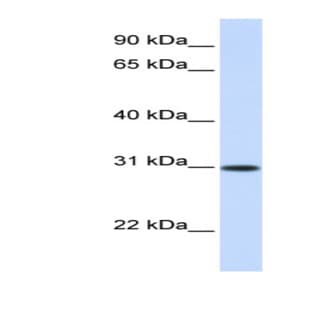 anti-Activating Transcription Factor 5 (ATF5) (Middle Region) antibody avatar