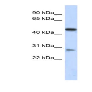 anti-Chromosome 13 Open Reading Frame 31 (C13orf31) (Middle Region) antibody avatar
