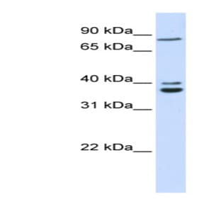 anti-Chromosome 18 Open Reading Frame 10 (C18orf10) (Middle Region) antibody avatar