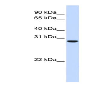 anti-Chromosome 18 Open Reading Frame 10 (C18orf10) (Middle Region) antibody avatar