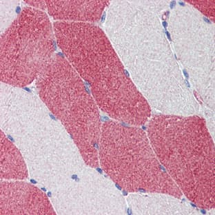 anti-3-Hydroxy-3-Methylglutaryl-CoA Synthase 1 (Soluble) (HMGCS1) (Middle Region) antibody avatar