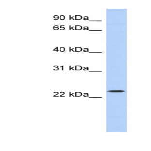 anti-Activating Transcription Factor 3 (ATF3) (Middle Region) antibody avatar