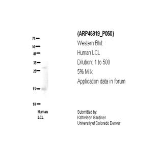 anti-Chromosome 21 Open Reading Frame 2 (C21orf2) (N-Term) antibody avatar