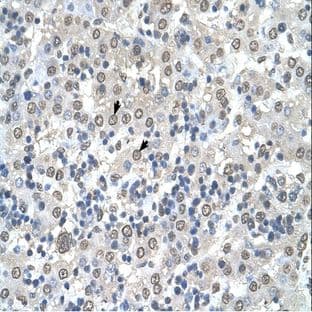 anti-Cerebellar Degeneration-Related Protein 2, 62kDa (CDR2) (N-Term) antibody avatar