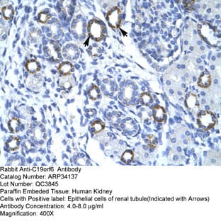 anti-Chromosome 19 Open Reading Frame 6 (C19orf6) (Middle Region) antibody avatar