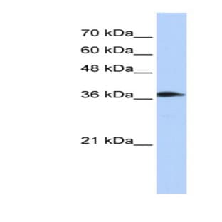 anti-ATPase, H+ Transporting, Lysosomal 38kDa, V0 Subunit D2 (ATP6V0D2) (Middle Region) antibody avatar