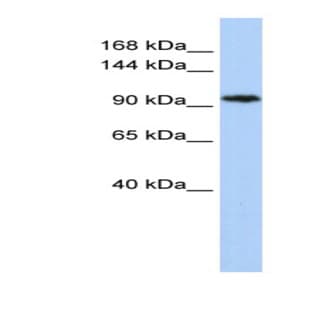 anti-Chromosome 11open Reading Frame 9 (C11orf9) (N-Term) antibody avatar