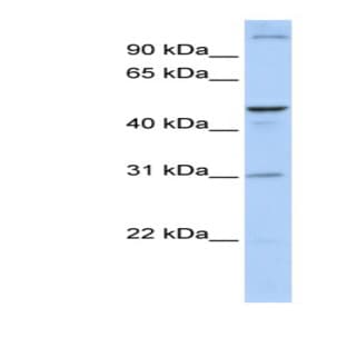 anti-Acyl-CoA Binding Domain Containing 5 (ACBD5) (N-Term) antibody avatar