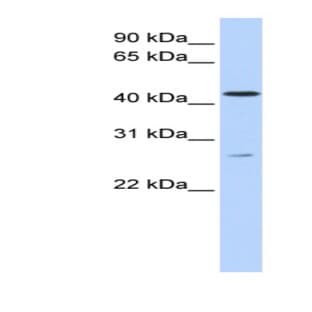 anti-Acyl-CoA Binding Domain Containing 5 (ACBD5) (C-Term) antibody avatar